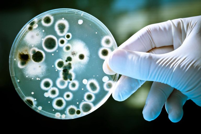 gloved hand holding up petri dish with organisms growing in it